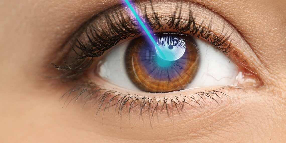 Tips to Prep for Lasik Eye Surgery and Ease Recovery