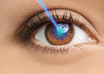 Tips to Prep for Lasik Eye Surgery and Ease Recovery